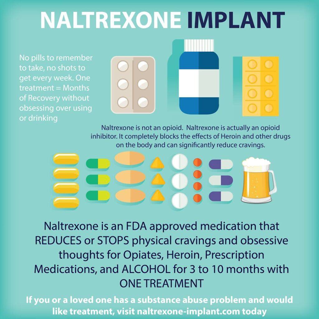 Infographic explaining Naltrexone implant benefits, including no daily pills, opioid inhibition, FDA approval, and effectiveness against various substance cravings for 3-10 months