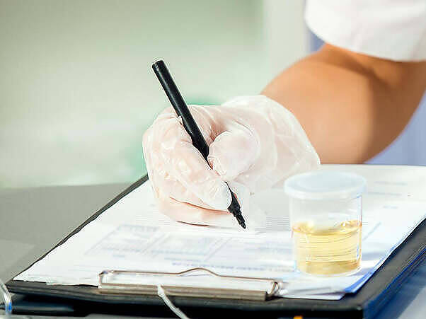 Close-up of gloved hands writing on a medical chart with a urine sample cup nearby, representing documentation of Dilaudid use in a clinical setting