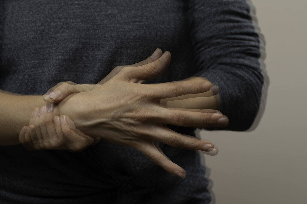 Close-up of hands exhibiting tremors, a typical sign of alcohol withdrawal syndrome