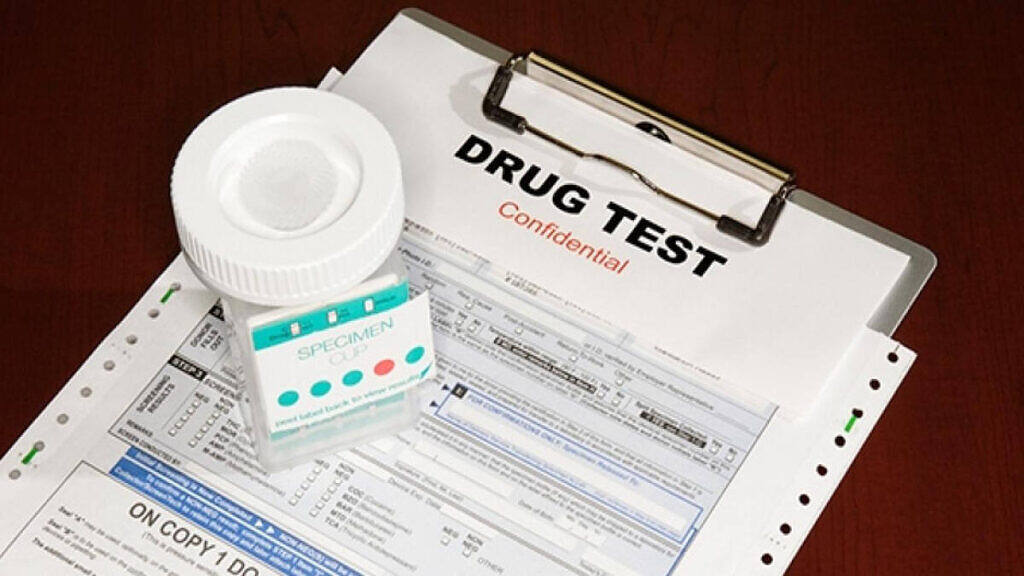 Drug test specimen container and confidential paperwork on clipboard for substance screening