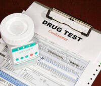 Drug test specimen container and confidential paperwork on clipboard for substance screening