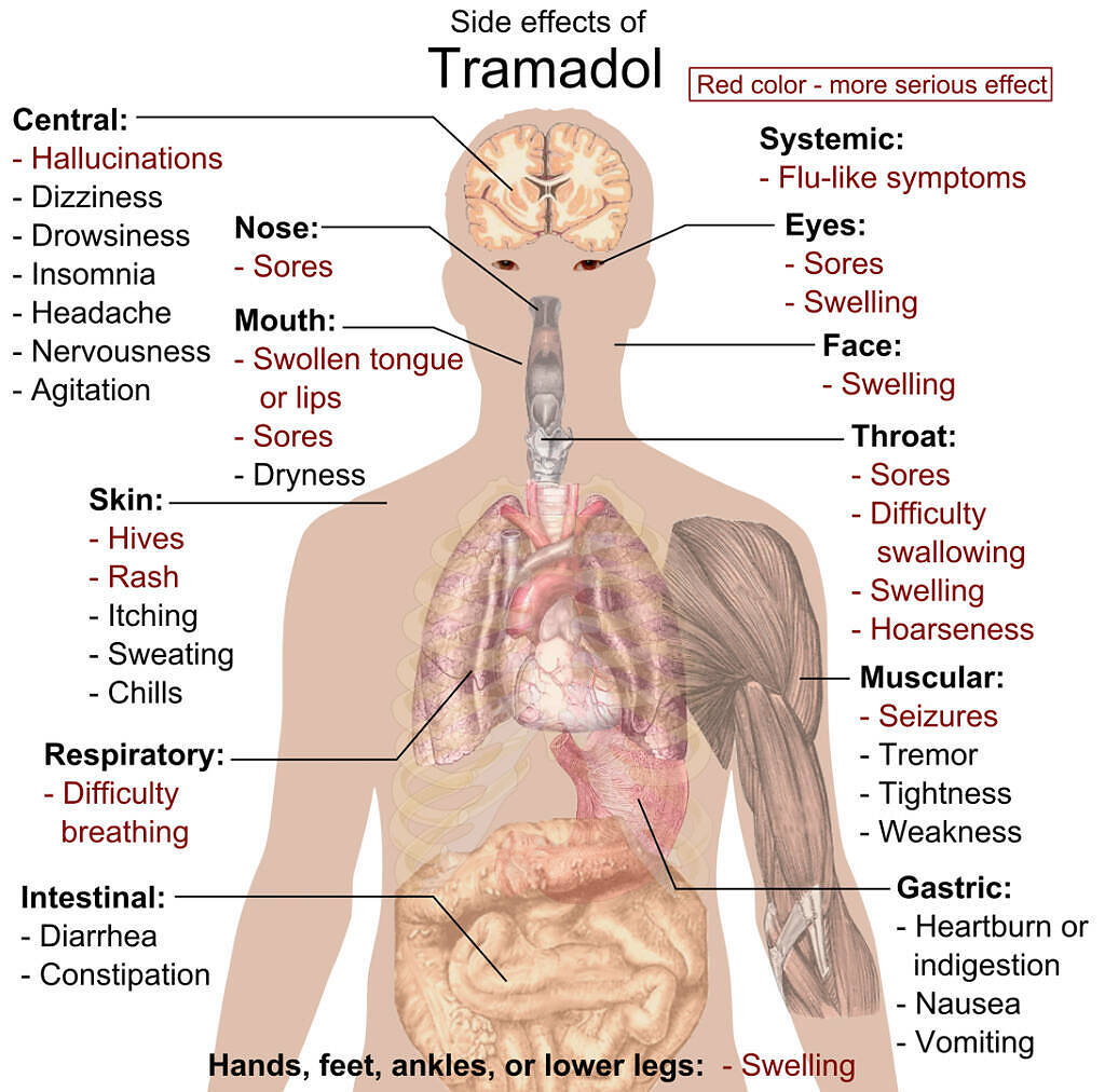 Detailed infographic showing various side effects of Tramadol on different body systems, including central, respiratory, gastric, and muscular, with more serious effects highlighted in red