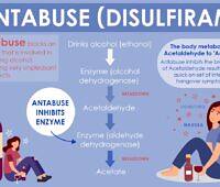 Infographic explaining how Antabuse (Disulfiram) blocks alcohol metabolism, causing unpleasant side effects when alcohol is consumed