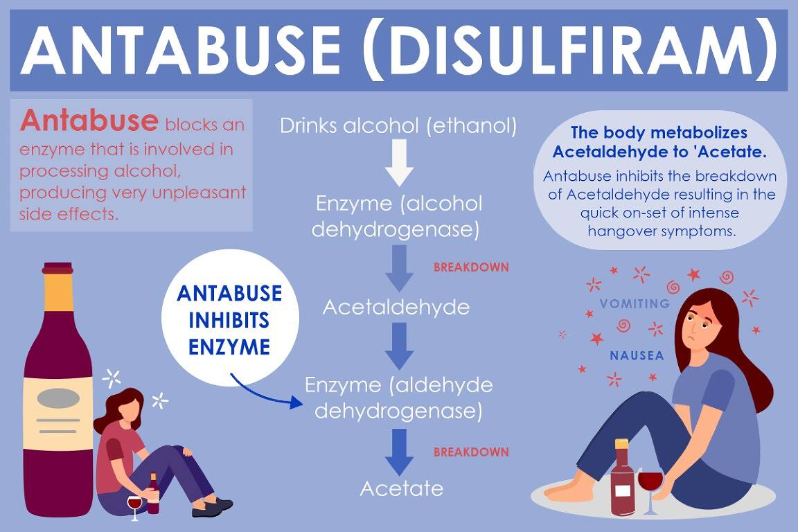 Infographic explaining how Antabuse (Disulfiram) blocks alcohol metabolism, causing unpleasant side effects when alcohol is consumed