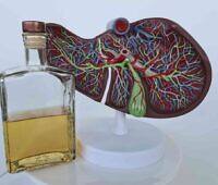 Model of a liver next to a bottle of alcohol, symbolizing the effects of alcohol on liver health