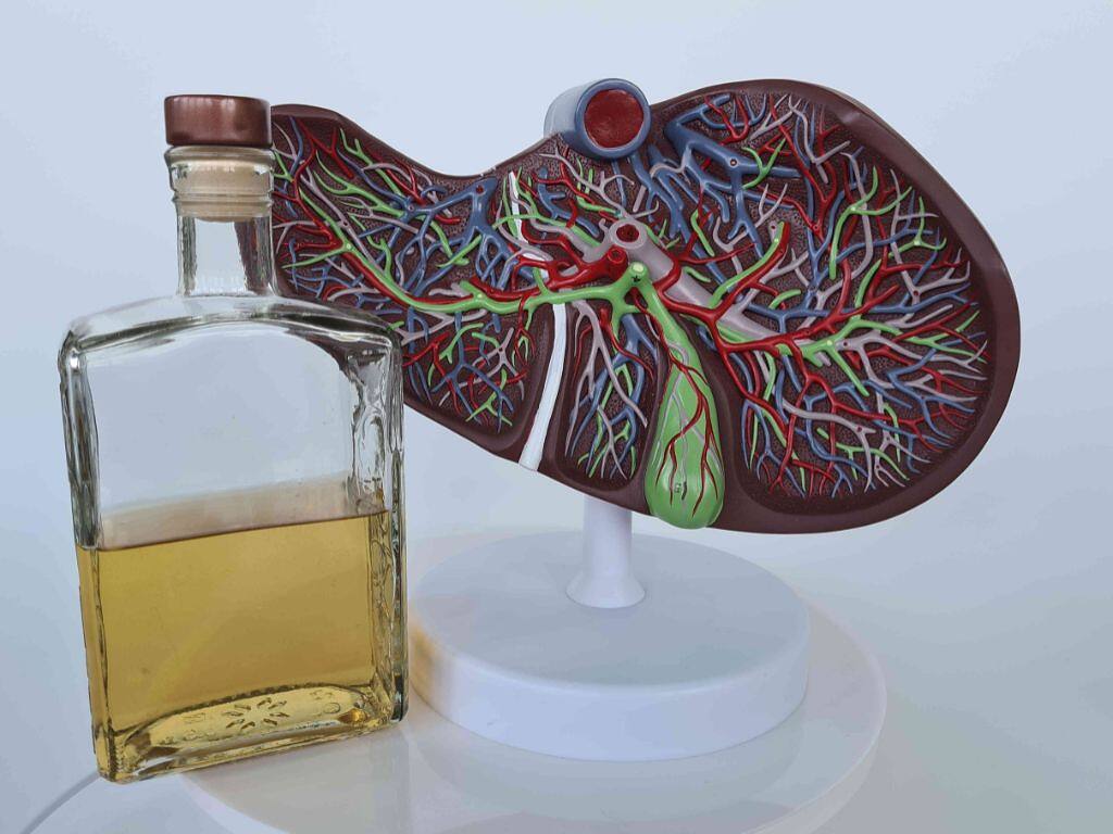 Model of a liver next to a bottle of alcohol, symbolizing the effects of alcohol on liver health